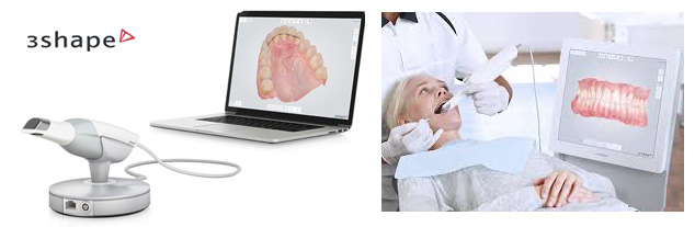 口腔内スキャナー