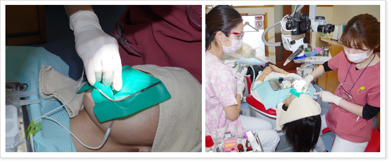 ラバーダム防湿法